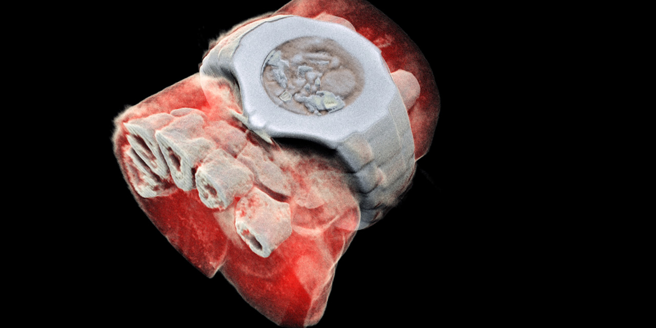 Première radiographie couleur 3D d&rsquo;un humain
