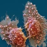 AI Saves Woman&rsquo;s Life By Identifying Her Disease When Other Methods (humans) Failed