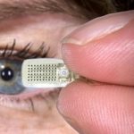 Cet oeil bionique redonne la vue à ceux qui l&rsquo;ont perdue