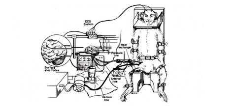 EXCLUSIF. Une greffe de tête réalisée chez le singe