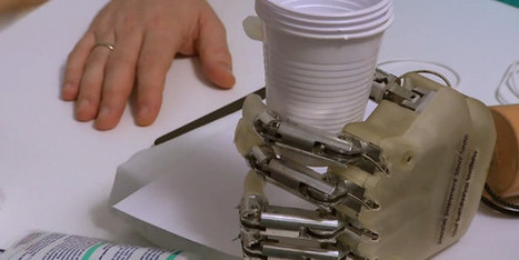 Un amputé du bras retrouve le toucher grâce à une prothèse bourrée d&rsquo;électronique