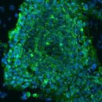 Un « mini-cerveau » obtenu à partir de cellules souches