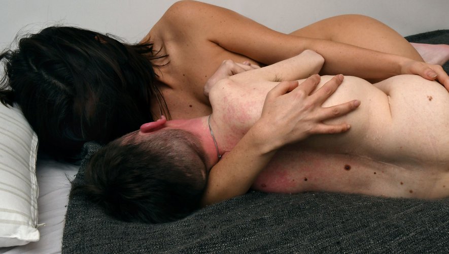 Le Haut conseil à l&rsquo;égalité clairement opposé à l&rsquo;assistance sexuelle des handicapés