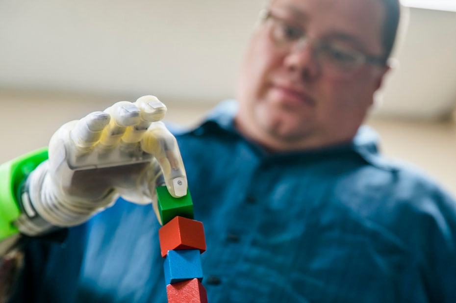 Une nouvelle technique aide les amputés à mieux contrôler leur neuroprothèse