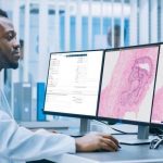 L’intelligence artificielle bientôt utilisée pour dépister le cancer, une première en France