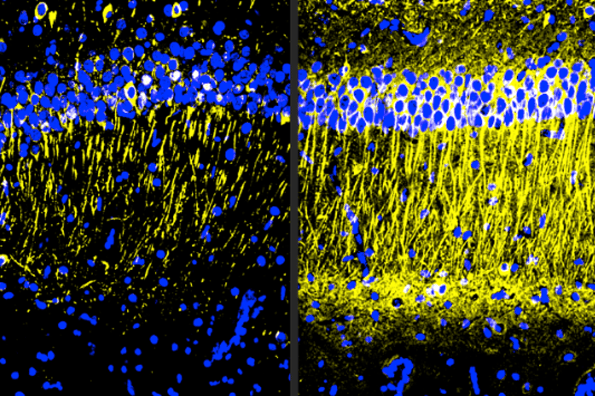 New molecule slams the brakes on Alzheimer’s brain inflammation