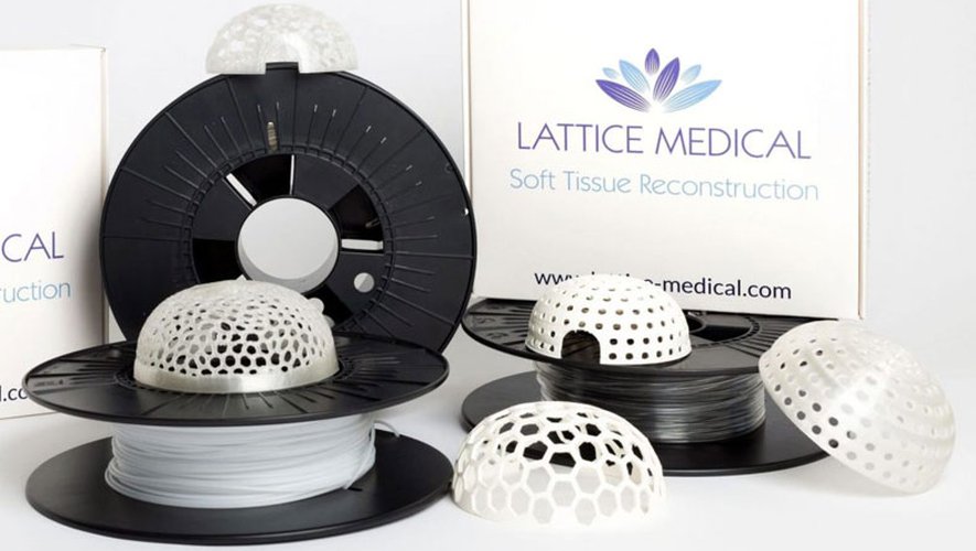 Lattice Medical met la 3D au service de la reconstruction mammaire