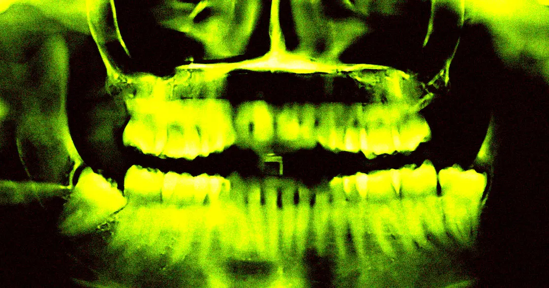 JAPANESE COMPANY TESTING DRUG TO REGROW TEETH IN HUMANS