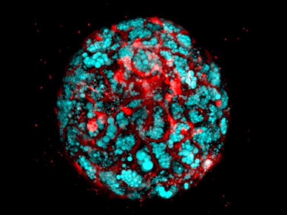 Organoïdes : ces mini-organes de laboratoire qui font avancer la médecine