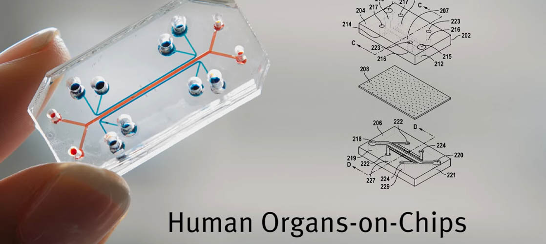 Human Organs-on-Chips