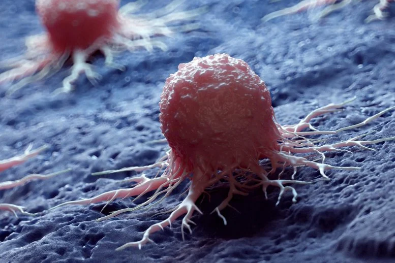 “Impending Disaster”: Scientists Warn That Cancer Deaths Are Surging Worldwide