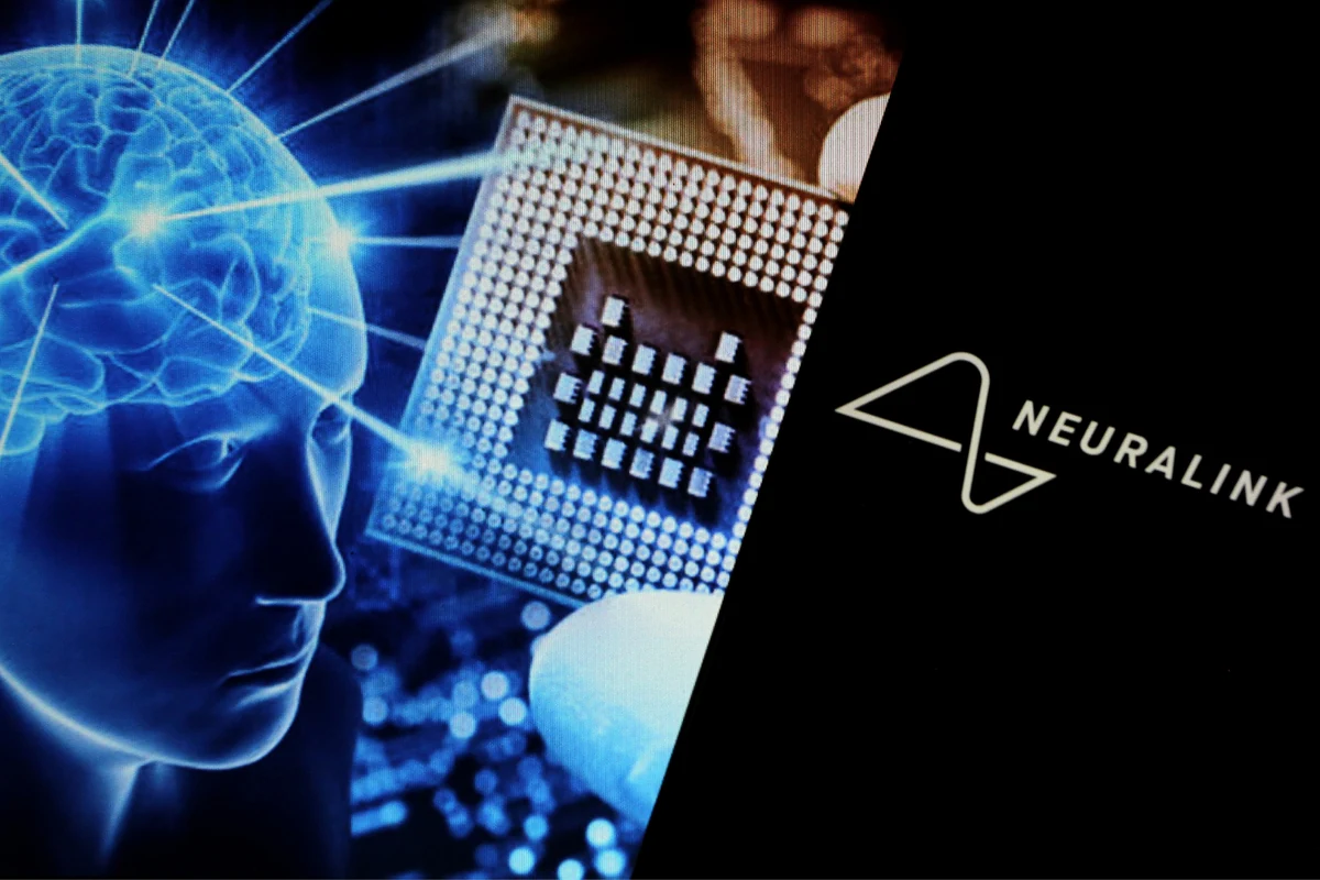 Neuralink implantera sa première puce de vision Blindsight chez un humain en 2025