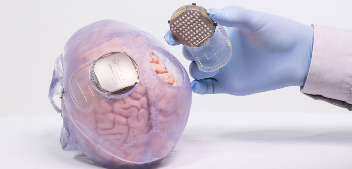 Le futur des implants médicaux