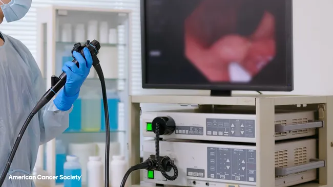 Colorectal cancer is now the most common cause of cancer deaths in the US for people under 50