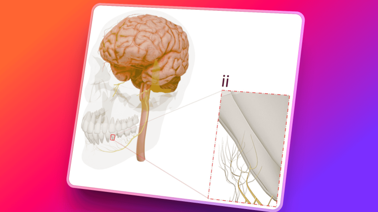 Smart Dental Implants: Restoring Sensation in Patient Care