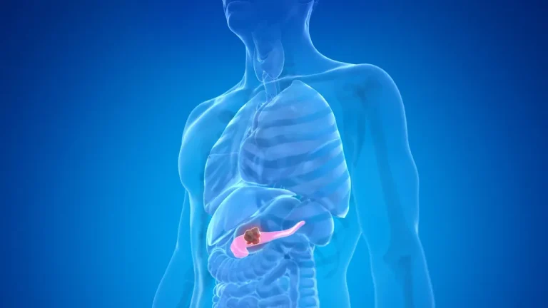 New AI model spots pancreatic cancer up to 3 years earlier than human doctors in test