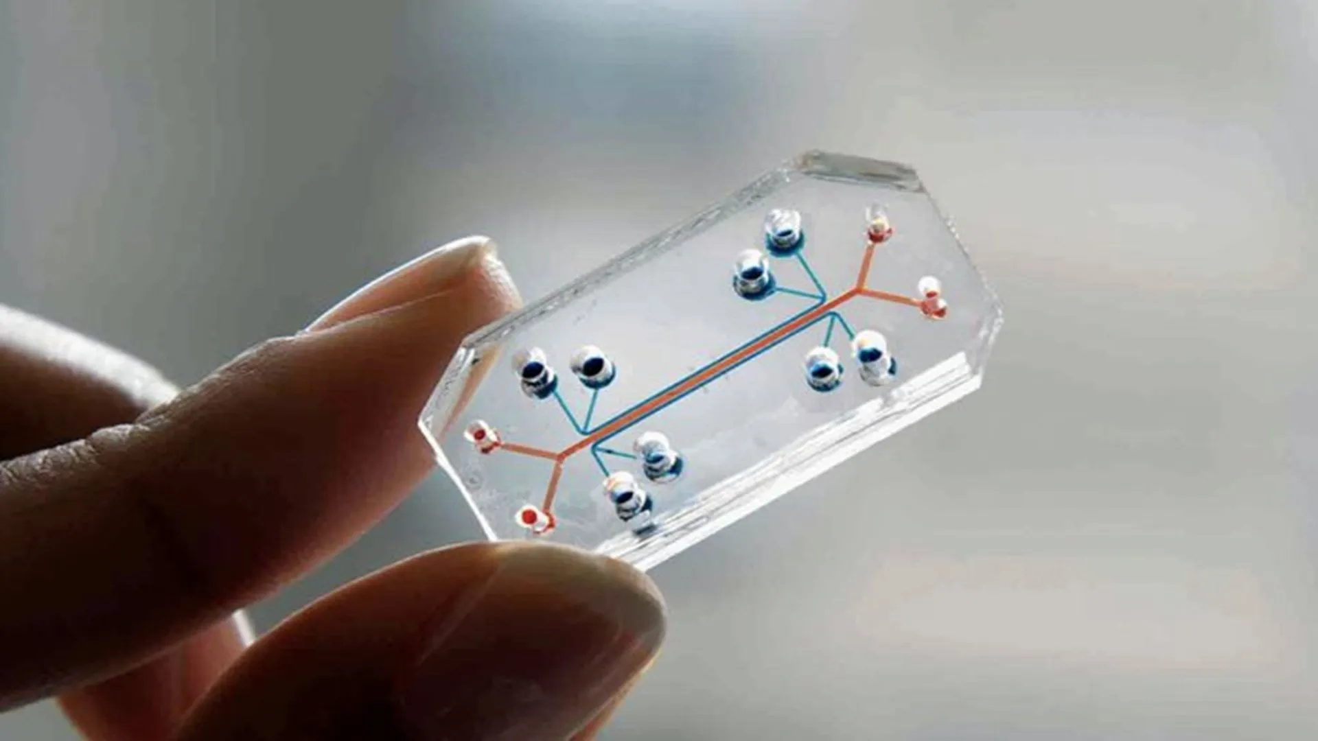 Scientists recreate IBD on chip, uncovering cancer-linked changes