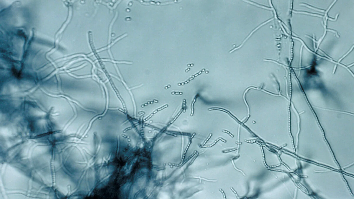 New Antibiotic Found in Dirt Targets Superbugs in a Way ‘Never Been Seen Before&rsquo;