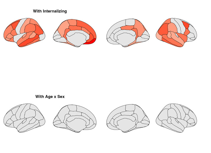Attention problems and cortical maturation in a large longitudinal sample of youths: The importance of accounting for sex differences