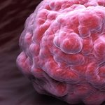 IA et recherche contre le cancer : six innovations inspirantes | Techniques de l&rsquo;Ingénieur