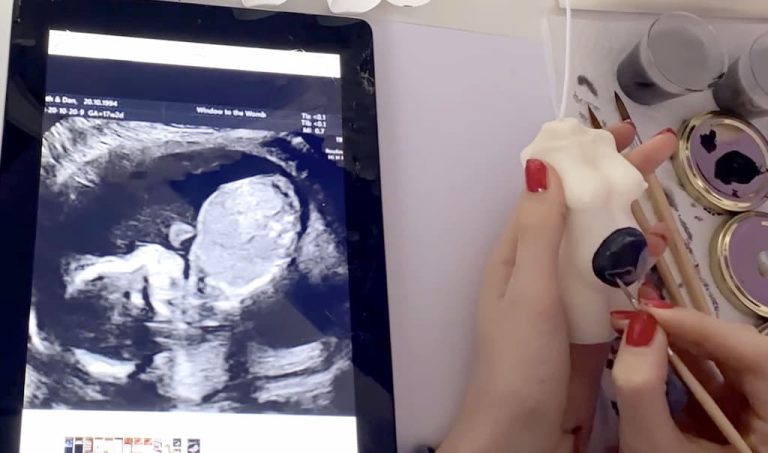 Le Massachusetts ouvre la voie de l’avortement « jusqu&rsquo;à la naissance »