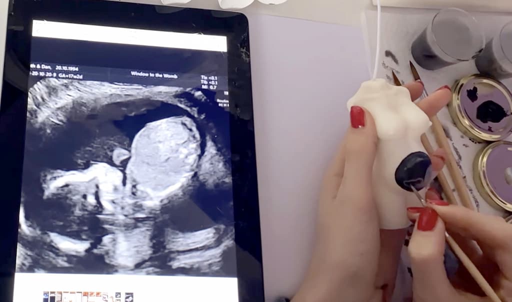 Le Massachusetts ouvre la voie de l’avortement « jusqu&rsquo;à la naissance »
