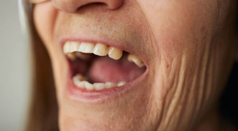 Médicament pour faire repousser les dents : phase I terminée – Dentaire365